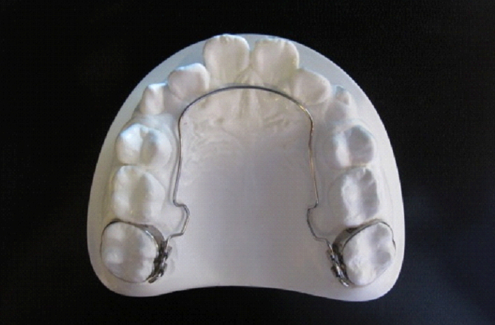 小児矯正の見えない装置
