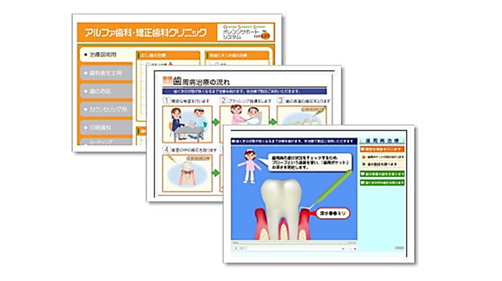 鳥栖にあるアルファ歯科の治療内容説明ソフト